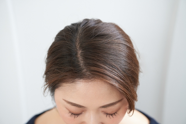 女性の悩み びまん性脱毛症 はすぐ治る 家でできるケア方法 仙台勝山館ココイル