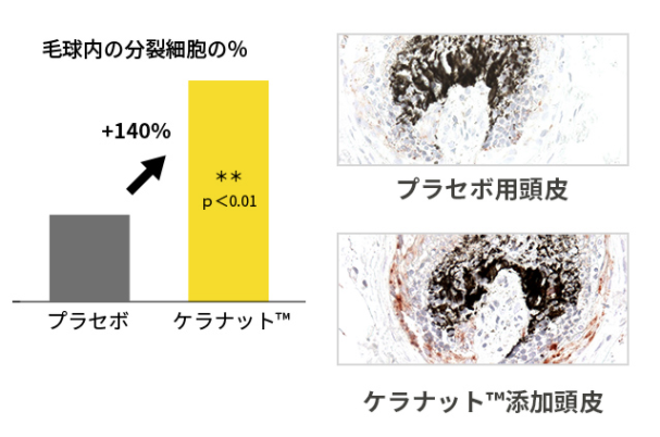 毛母細胞の活性化を図式した画像
